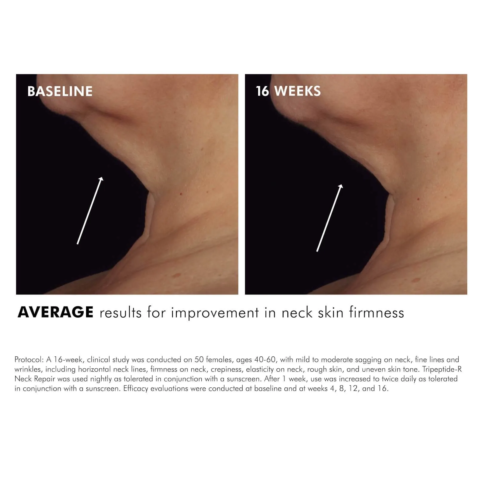 SkinCeuticals | Tripeptide-R Neck Repair 50ml